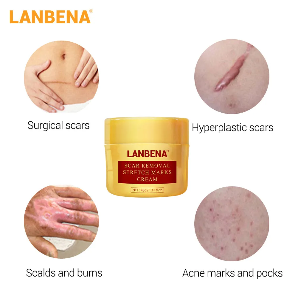 LANBENA Herbal Cream